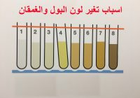 اسباب تغير لون البول